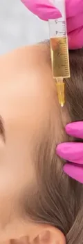 prp-for-hair